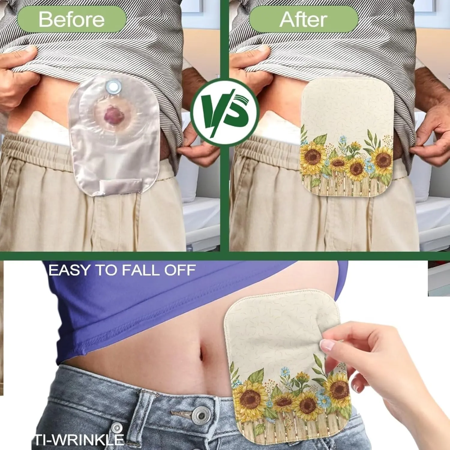 Rnyleeg 4-Piece Ostomy Pouch Covers for Women Sunflower Colostomy Supplies for Home Work Travel Portable Ostomy Bag Accessories